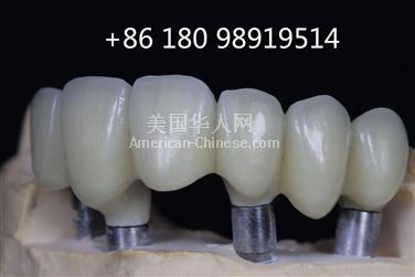 阿罕布拉FDA认证的中国牙科实验室寻找美国分销商